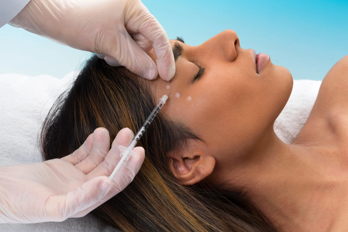 Botox vs fillers: wat is het verschil en is het de moeite waard?