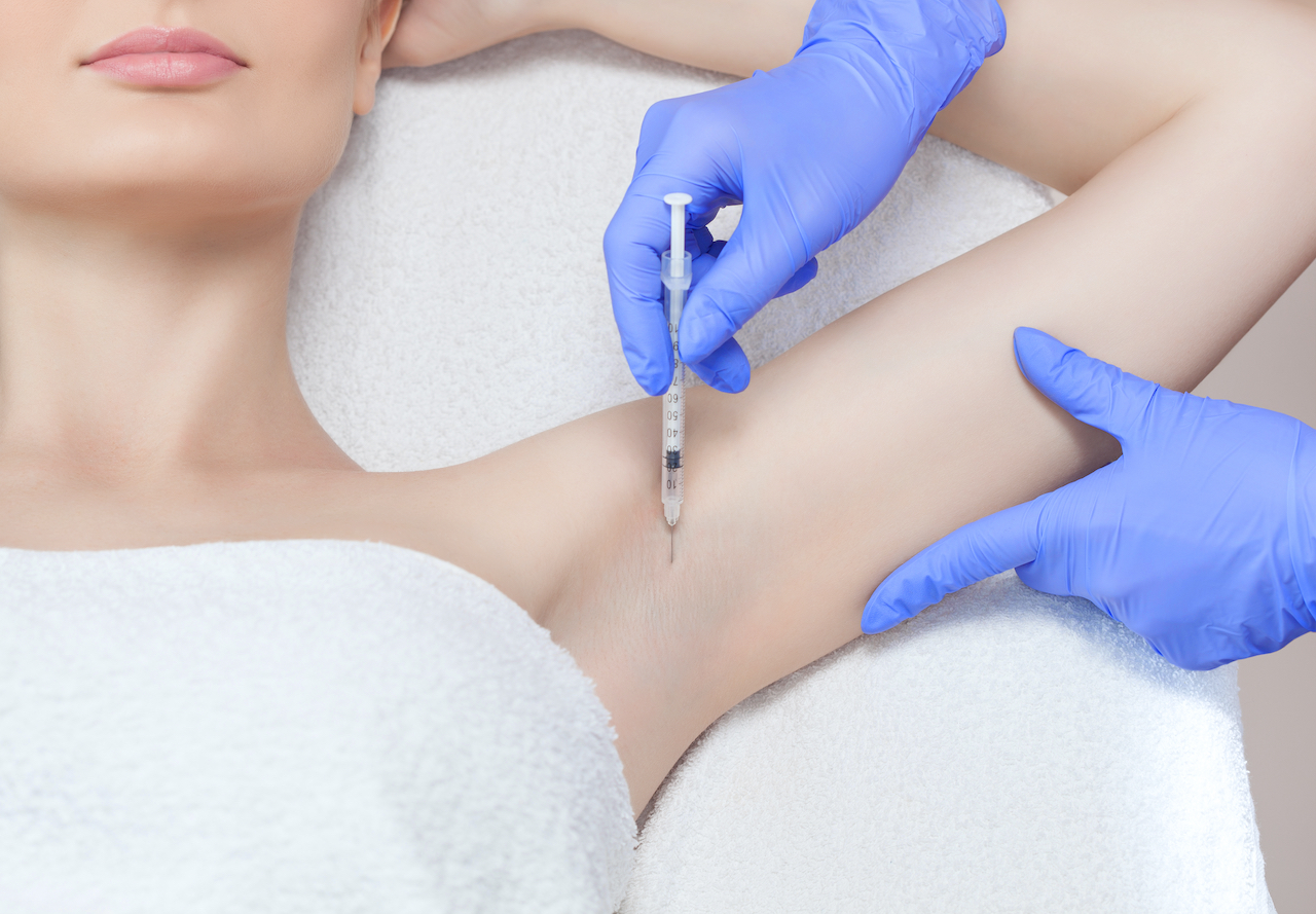 Botox tegen zweten (Hyperhidrose-behandeling): Alles wat je moet weten